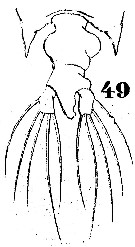 Espce Pontellopsis perspicax - Planche 2 de figures morphologiques