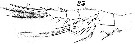 Espce Labidocera wollastoni - Planche 16 de figures morphologiques