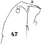 Espce Anomalocera patersoni - Planche 15 de figures morphologiques