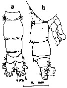 Espce Acartia (Acanthacartia) plumosa - Planche 3 de figures morphologiques