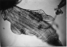 Espce Euchirella messinensis - Planche 13 de figures morphologiques