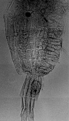Espce Pleuromamma gracilis - Planche 5 de figures morphologiques