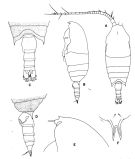 Espce Aetideopsis minor - Planche 1 de figures morphologiques
