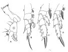 Espce Aetideopsis rostrata - Planche 2 de figures morphologiques