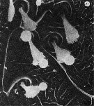 Espce Benthomisophria palliata - Planche 9 de figures morphologiques