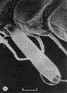 Espce Benthomisophria palliata - Planche 10 de figures morphologiques
