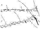 Espce Euchaeta rimana - Planche 7 de figures morphologiques