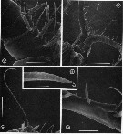 Species Euchaeta rimana - Plate 11 of morphological figures