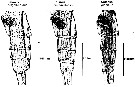Espce Calanus glacialis - Planche 4 de figures morphologiques