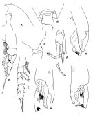 Espce Paraeuchaeta hanseni - Planche 3 de figures morphologiques