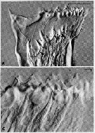 Espce Neocalanus plumchrus - Planche 22 de figures morphologiques