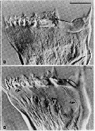 Espce Neocalanus cristatus - Planche 4 de figures morphologiques