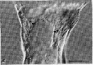 Espce Neocalanus cristatus - Planche 6 de figures morphologiques