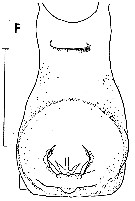 Espce Paraeuchaeta tuberculata - Planche 6 de figures morphologiques
