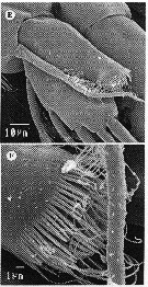 Espce Methanocalanus gabonicus - Planche 6 de figures morphologiques