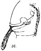 Espce Acartia (Acartia) danae - Planche 10 de figures morphologiques