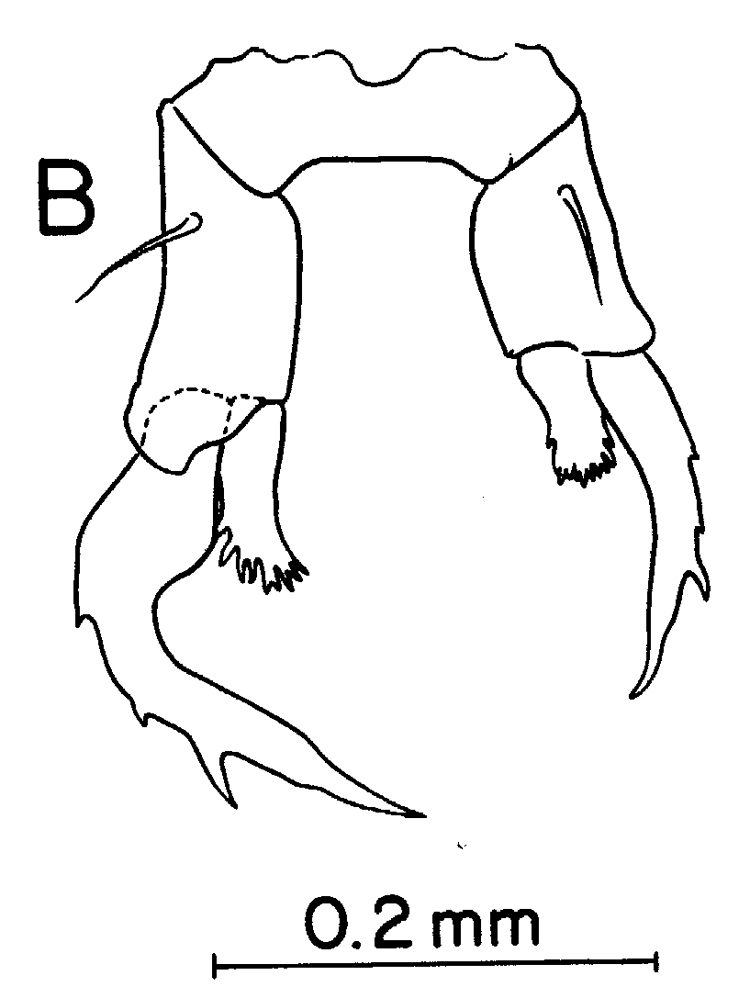 Espèce Labidocera moretoni - Planche 4 de figures morphologiques
