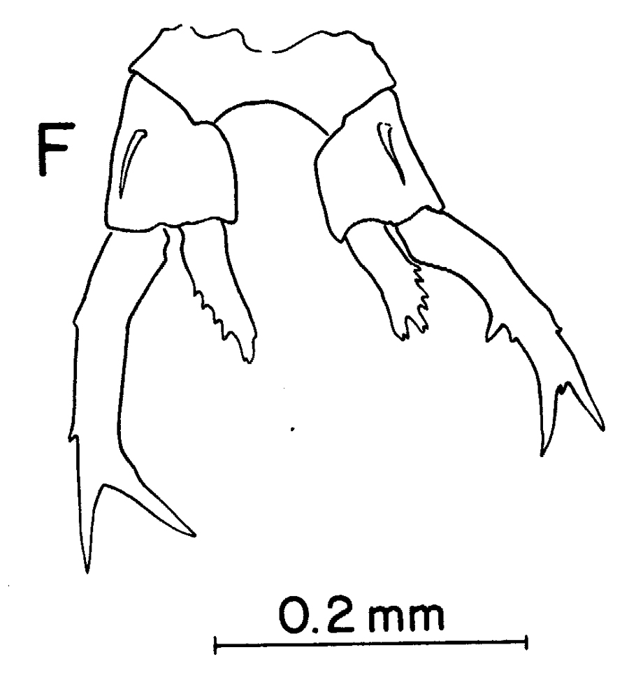 Espce Labidocera rotunda - Planche 7 de figures morphologiques