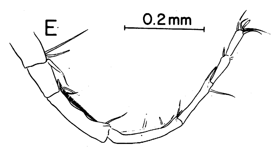 Espce Labidocera pectinata - Planche 10 de figures morphologiques