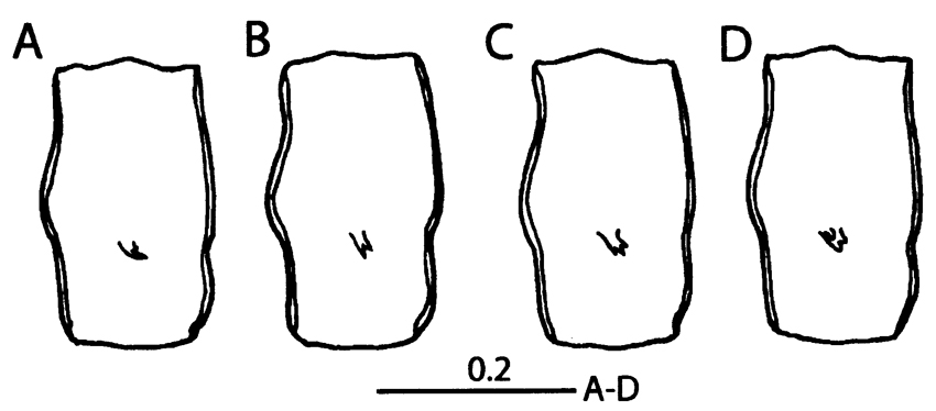 Espèce Labidocera boxshalli - Planche 4 de figures morphologiques