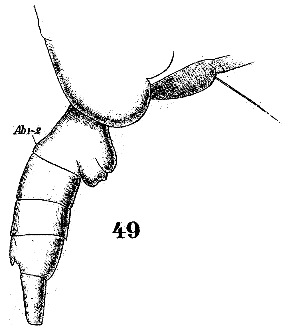 Espèce Spinocalanus abyssalis - Planche 7 de figures morphologiques