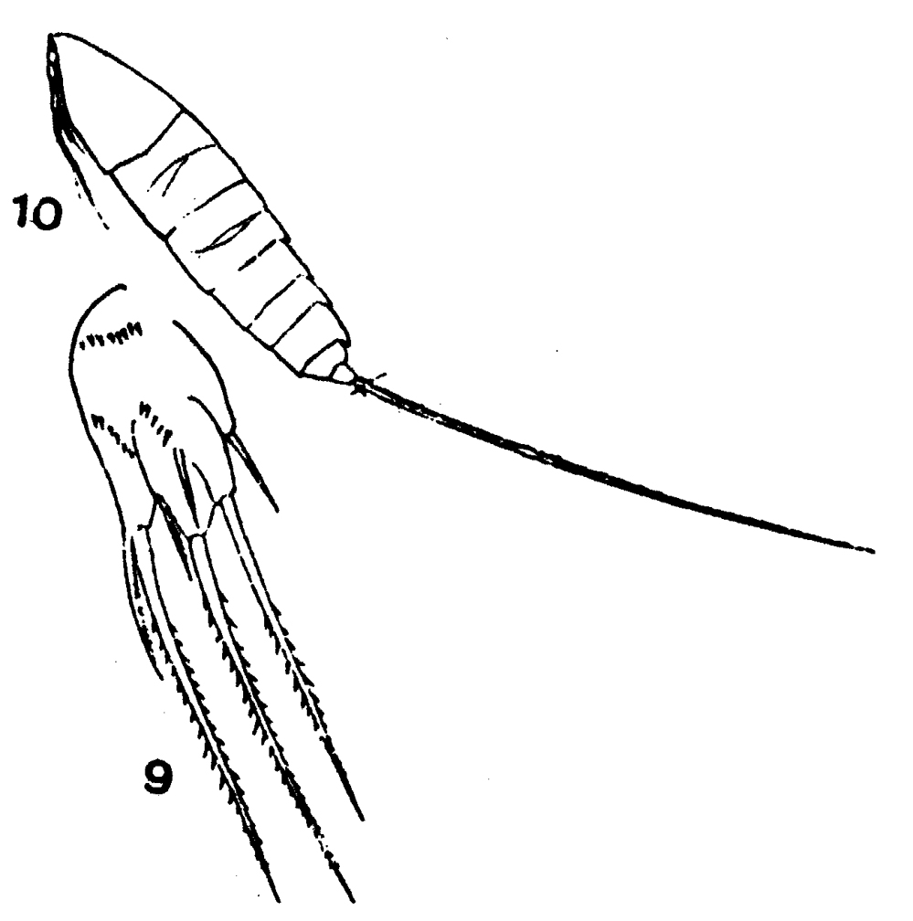 Espce Microsetella norvegica - Planche 7 de figures morphologiques