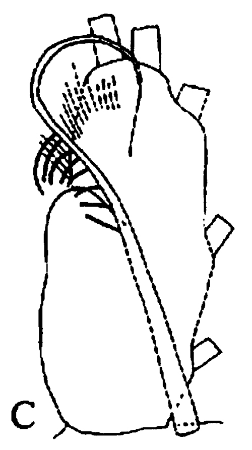 Espce Tharybis juhlae - Planche 7 de figures morphologiques