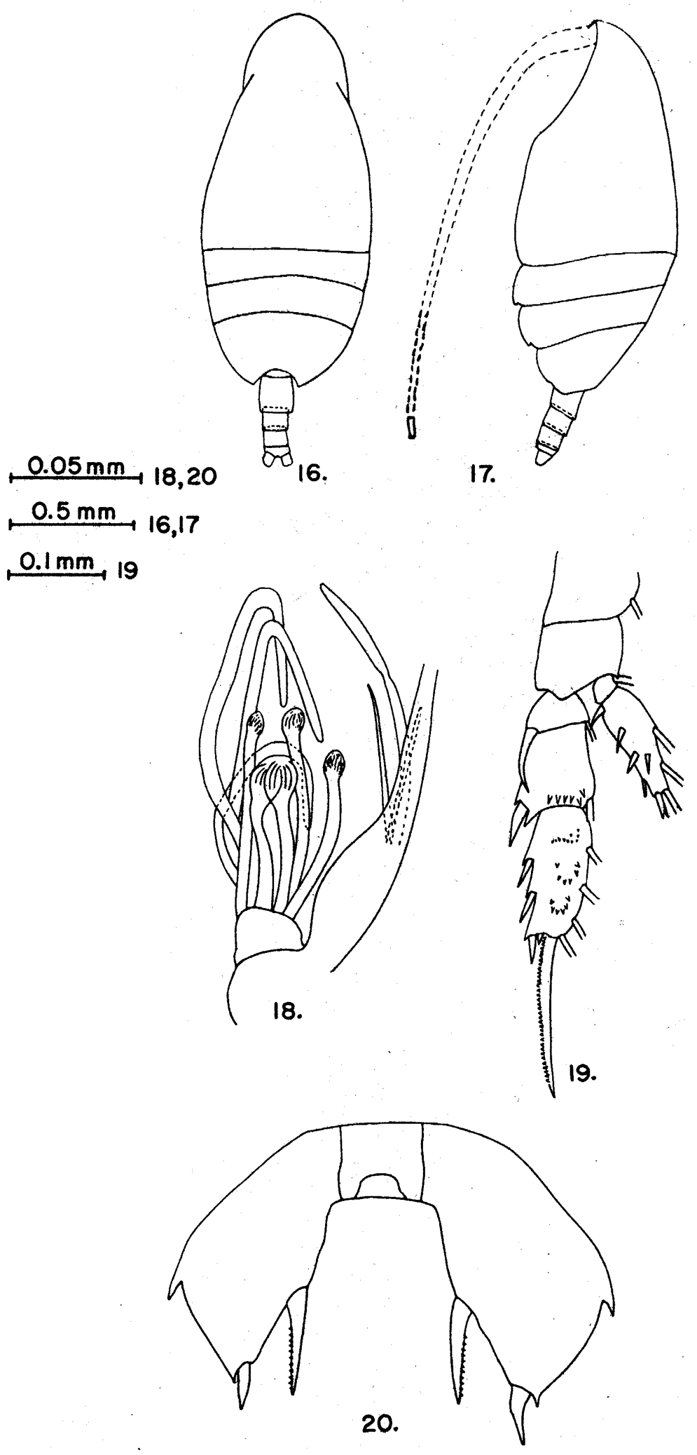 Espèce Scolecithricella abyssalis - Planche 10 de figures morphologiques
