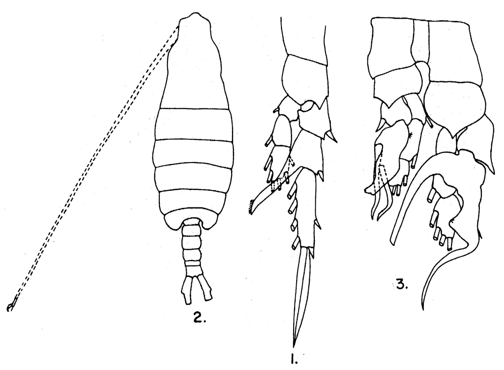 Espèce Centropages gracilis - Planche 7 de figures morphologiques