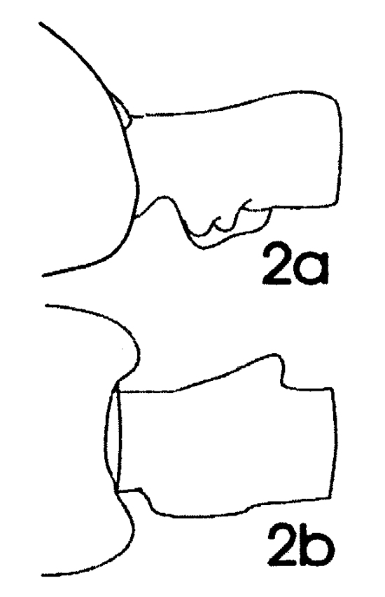 Espèce Euchaeta marina - Planche 9 de figures morphologiques