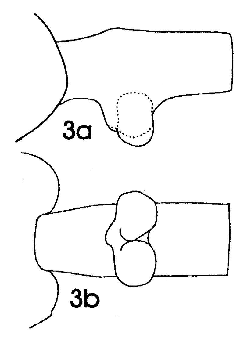 Espce Euchaeta spinosa - Planche 9 de figures morphologiques
