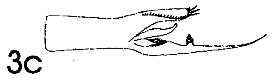 Espce Euchaeta spinosa - Planche 10 de figures morphologiques