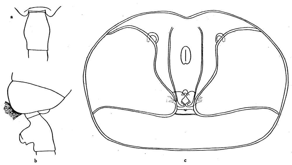Espce Paraeuchaeta bradyi - Planche 4 de figures morphologiques