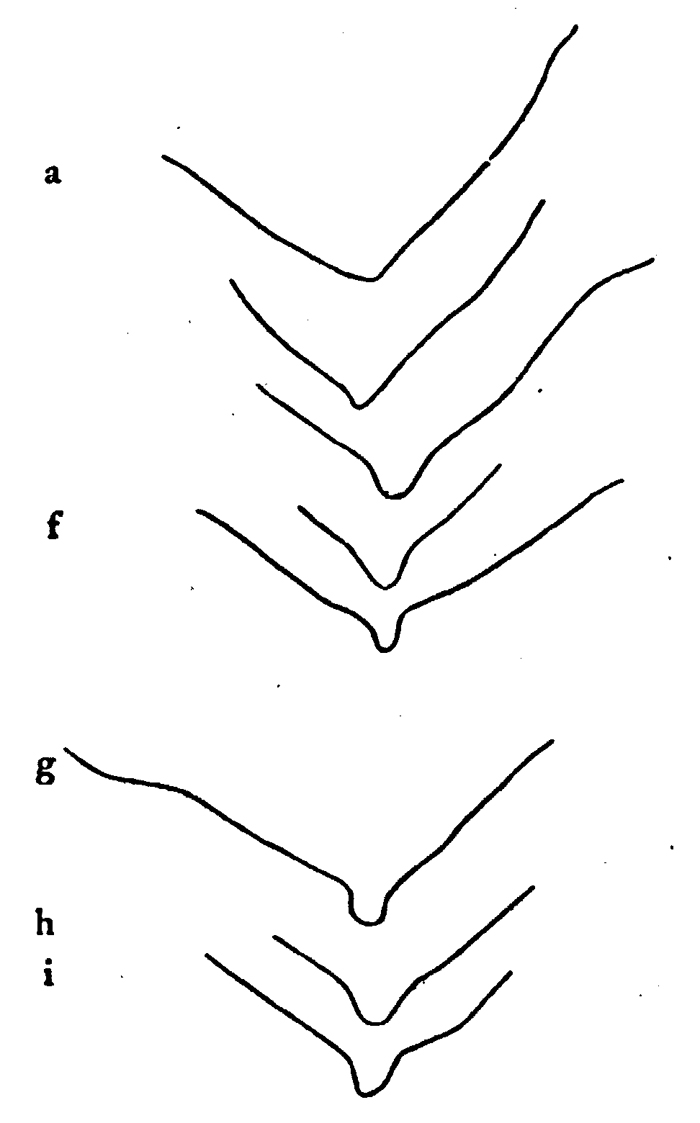 Espce Scaphocalanus magnus - Planche 18 de figures morphologiques