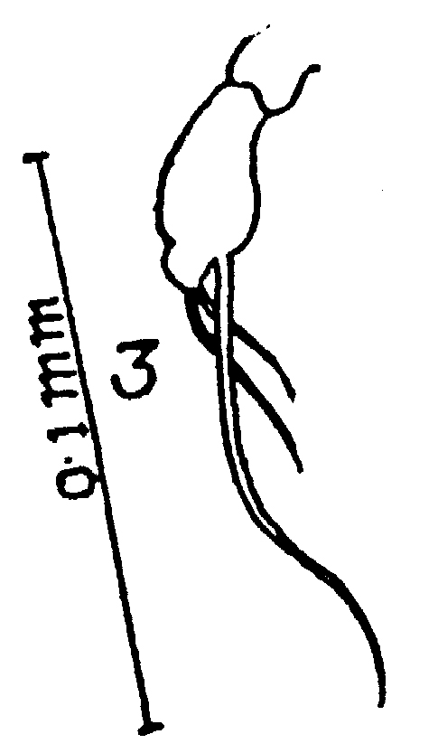 Espèce Metacalanus aurivilli - Planche 4 de figures morphologiques