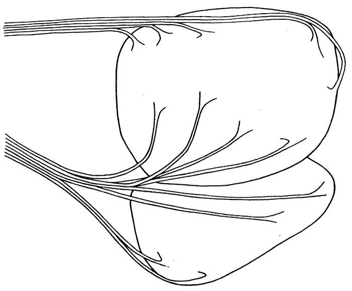 Espce Paraeuchaeta norvegica - Planche 13 de figures morphologiques