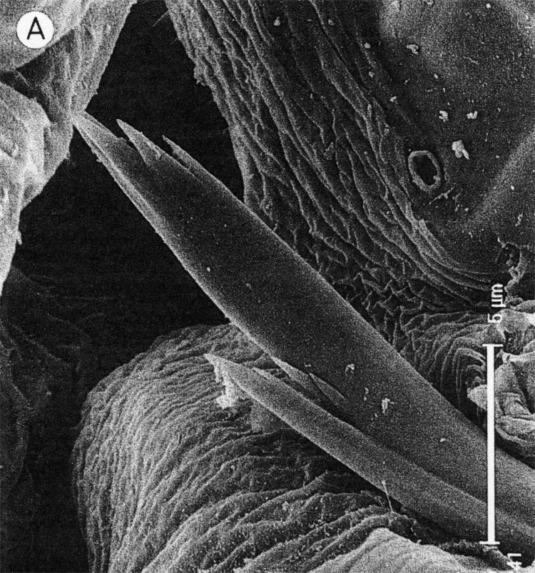 Espèce Clytemnestra gracilis - Planche 18 de figures morphologiques