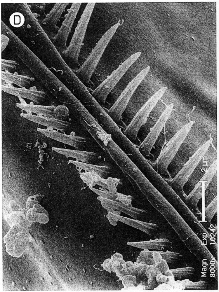 Espèce Clytemnestra gracilis - Planche 19 de figures morphologiques