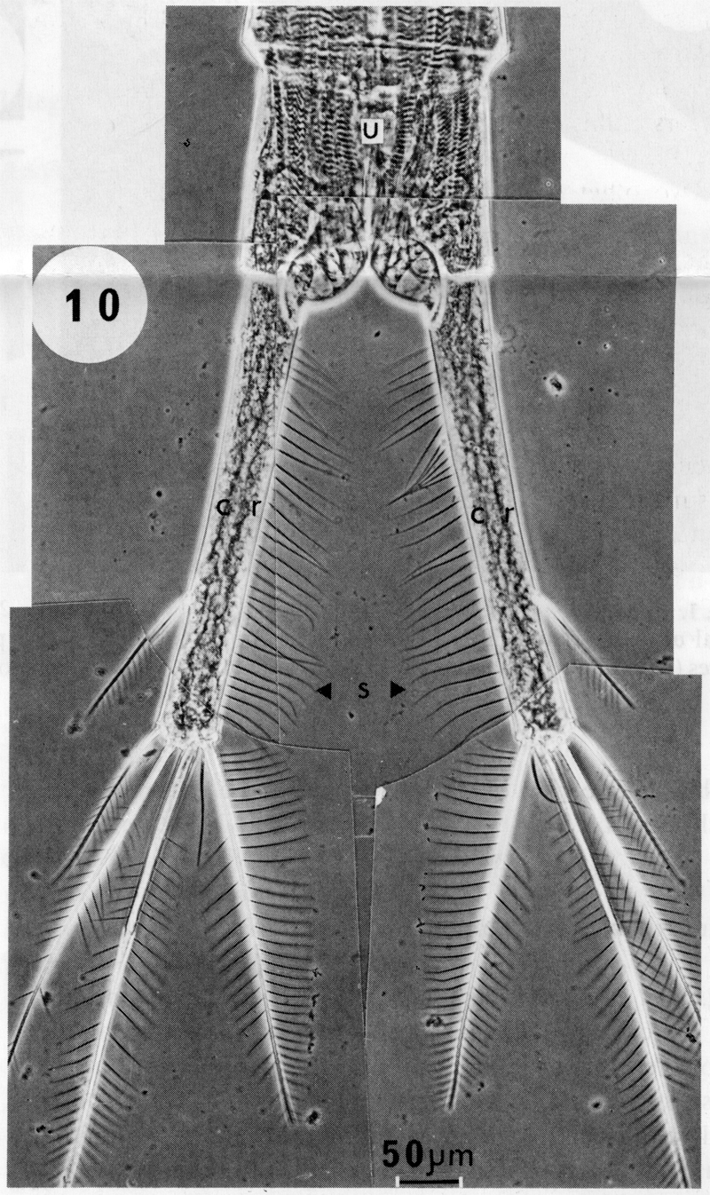 Espce Temora longicornis - Planche 9 de figures morphologiques