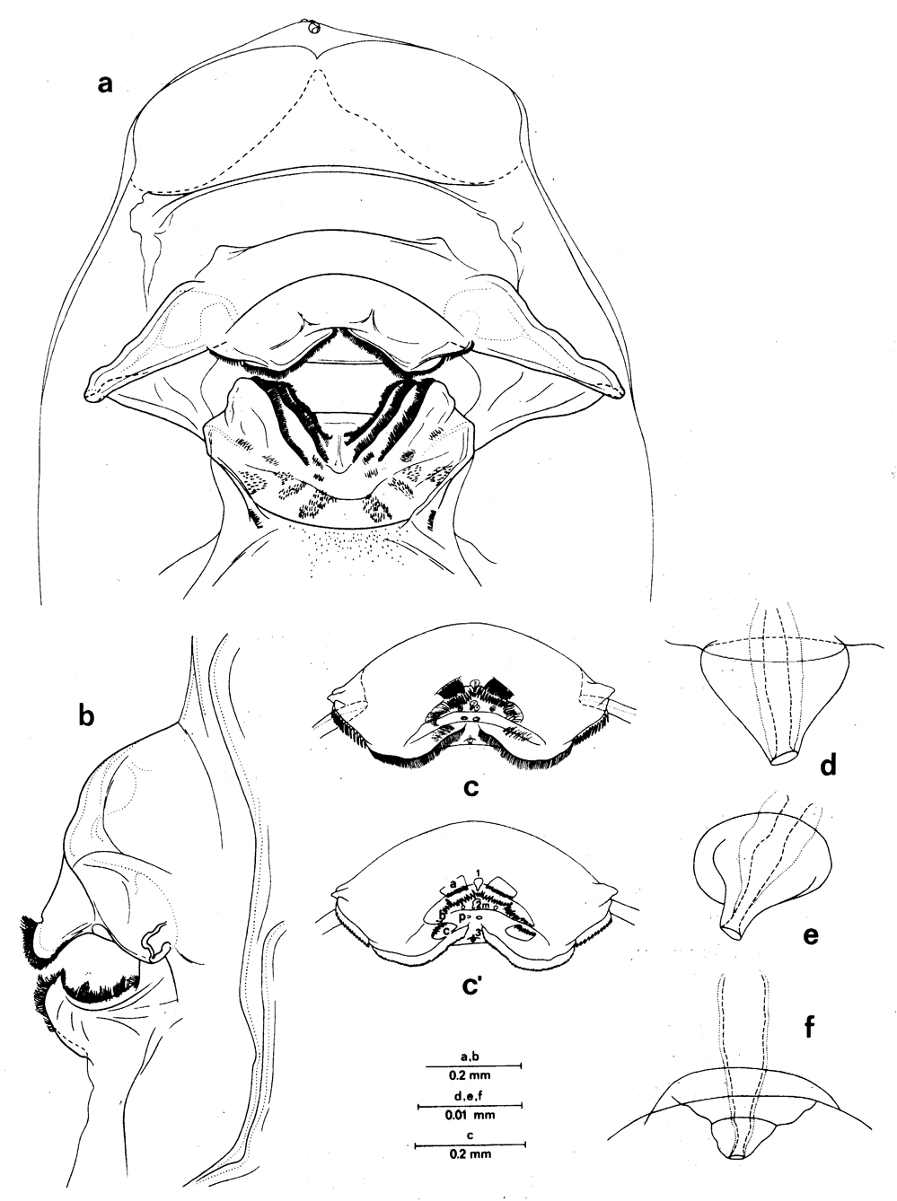 Espèce Euchirella messinensis - Planche 23 de figures morphologiques