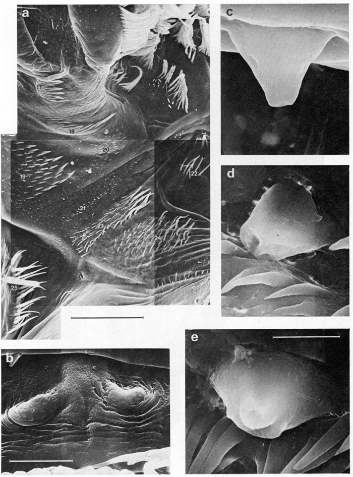 Espèce Euchirella messinensis - Planche 25 de figures morphologiques
