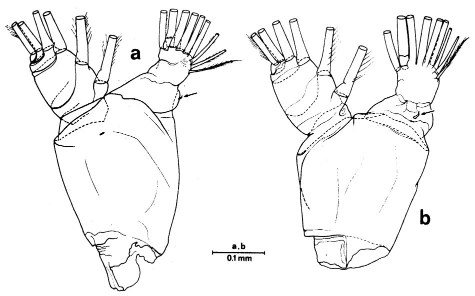 Espce Euchirella messinensis - Planche 33 de figures morphologiques