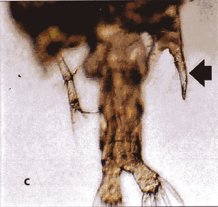 Espce Labidocera kryeri - Planche 16 de figures morphologiques