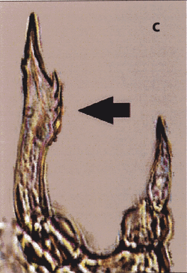 Species Tortanus (Tortanus) barbatus - Plate 5 of morphological figures