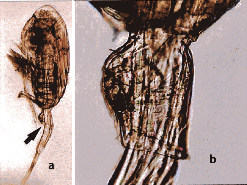 Espèce Pseudodiaptomus ardjuna - Planche 2 de figures morphologiques