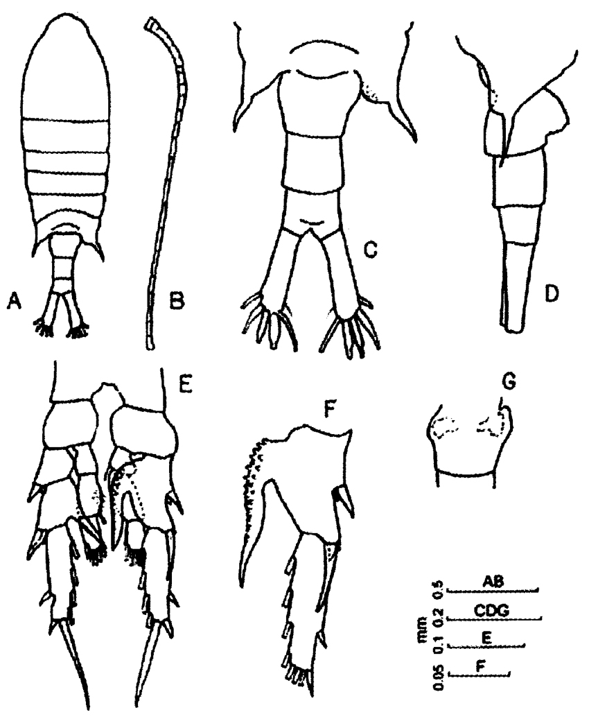 Espèce Centropages tenuiremis - Planche 9 de figures morphologiques