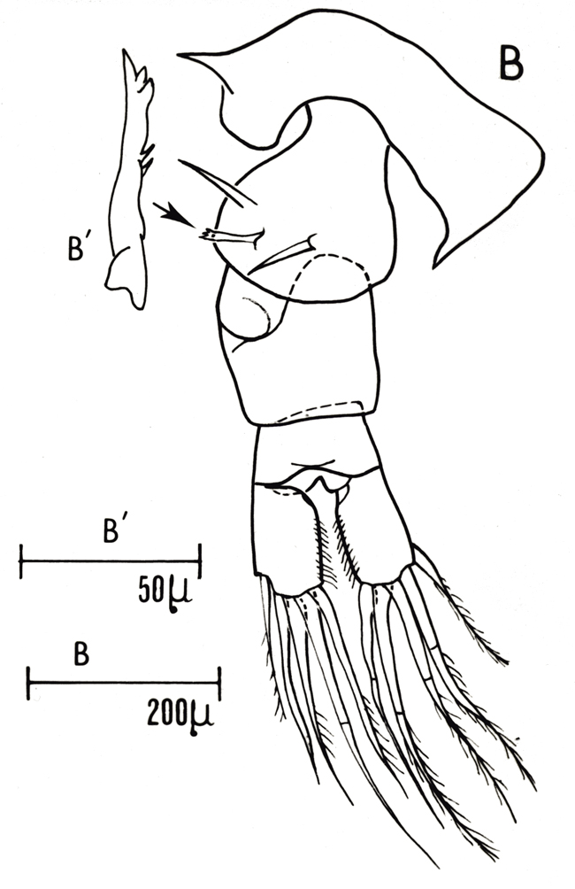 Espce Centropages chierchiae - Planche 2 de figures morphologiques