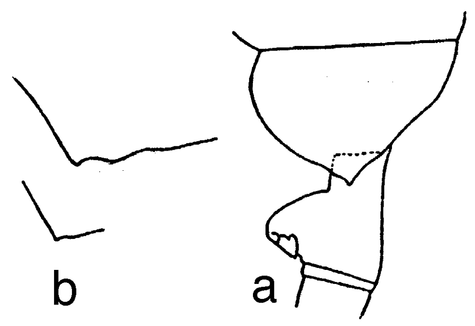 Espèce Paraeuchaeta pseudotonsa - Planche 14 de figures morphologiques