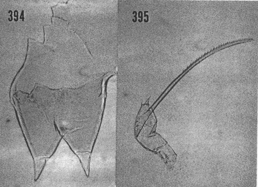 Espce Scottocalanus helenae - Planche 16 de figures morphologiques