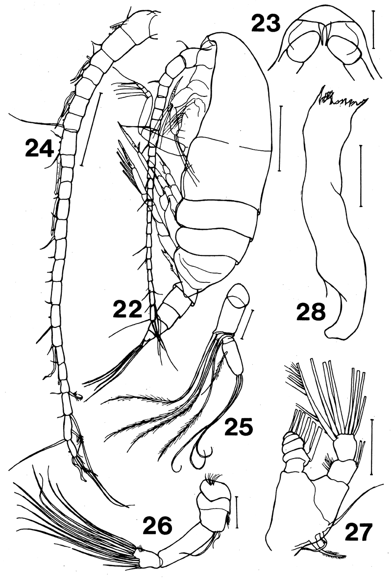 Espèce Xanthocalanus marlyae - Planche 5 de figures morphologiques